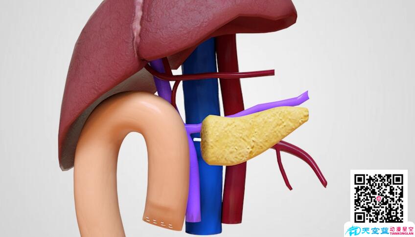 三維3d動畫演示胰十二指腸切除術.jpg