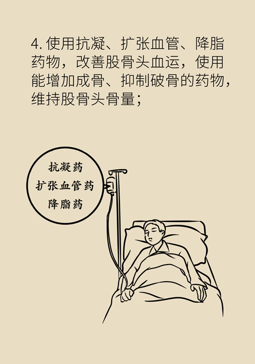 激素會帶來股骨頭壞死的后遺癥嗎？