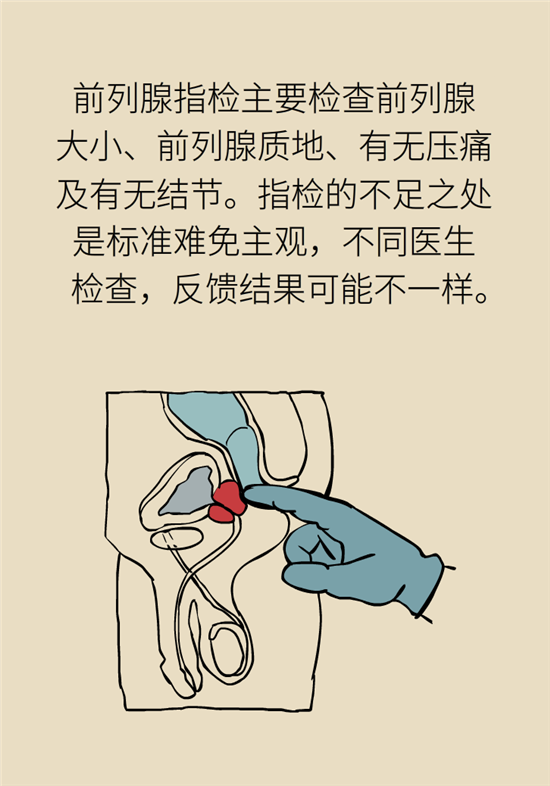 前列腺肥大了還能縮小嗎？