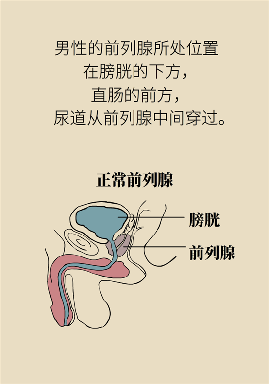 前列腺肥大了還能縮小嗎？