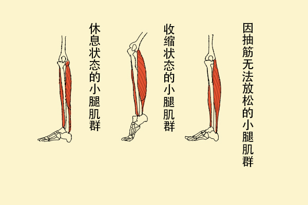 為什么缺鈣會導(dǎo)致抽筋？