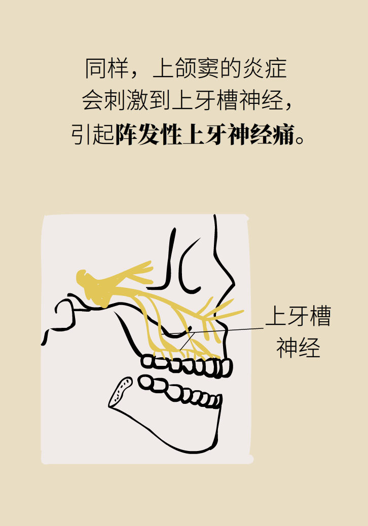 為什么鼻竇發(fā)炎，疼的卻是頭、眼和牙？