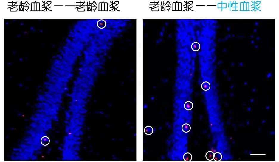 重返年輕不用大換血，只要給血液“兌點水”？