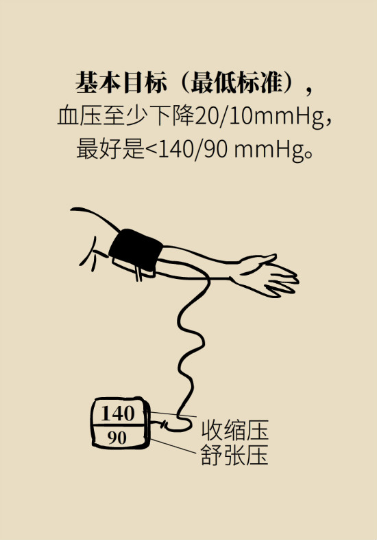 2020年高血壓指南更新！這些重要的改動要記住