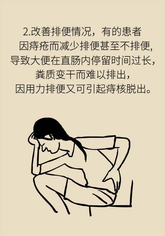 長(zhǎng)“痔”如何久安？專家的建議來(lái)了