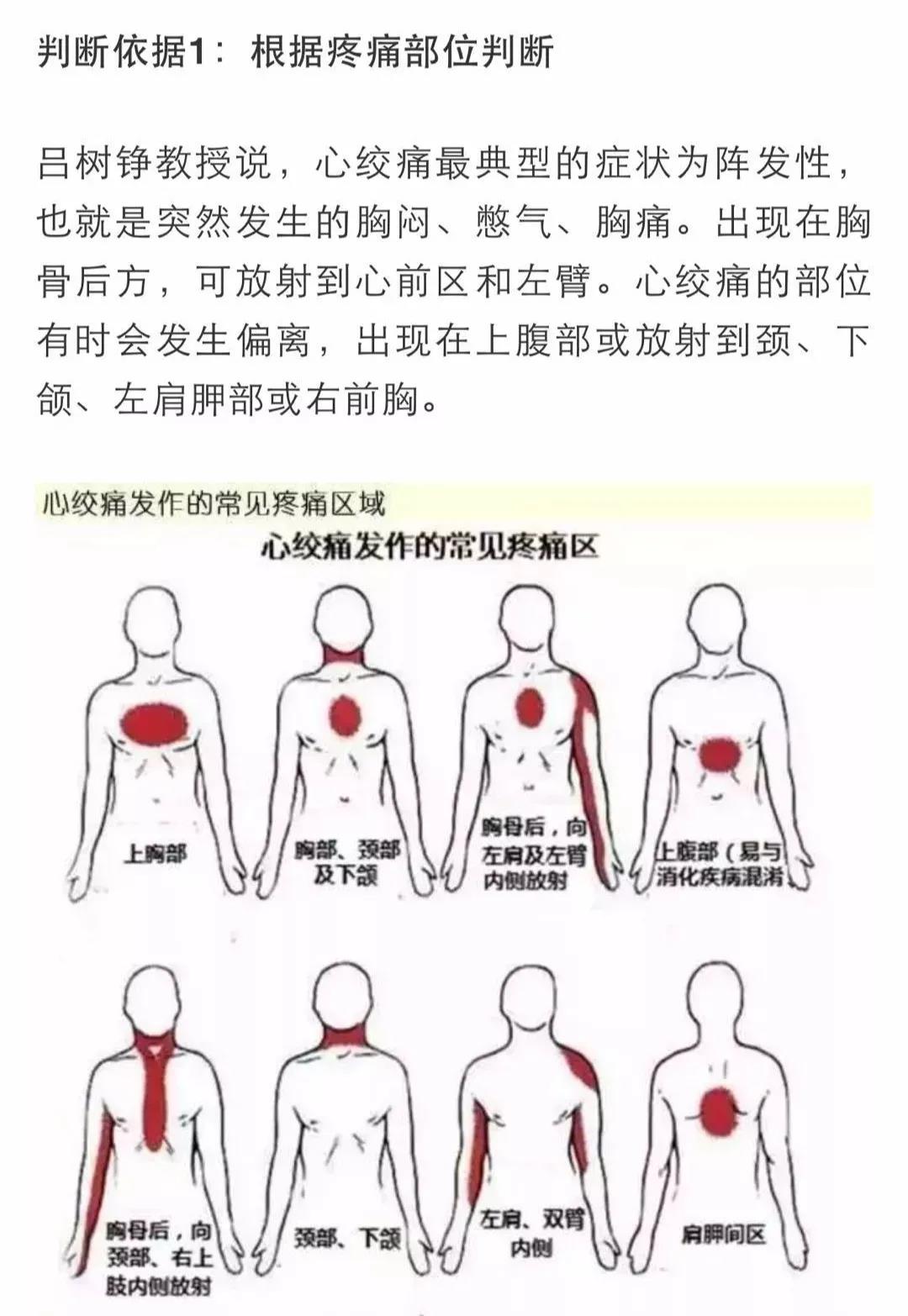 心梗有前兆！心臟發(fā)出的警報(bào)你在意了嗎？