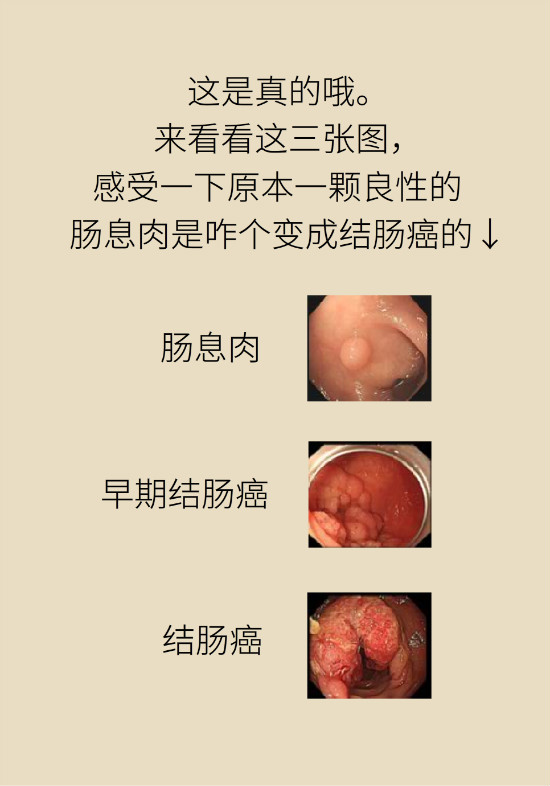 大腸癌科普動(dòng)漫制作