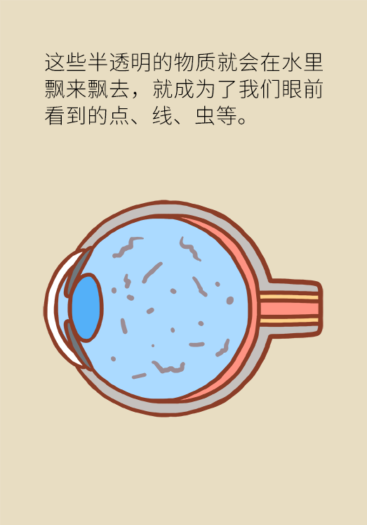 眼科醫(yī)學(xué)科普動漫