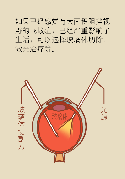 眼科醫(yī)學(xué)科普動漫