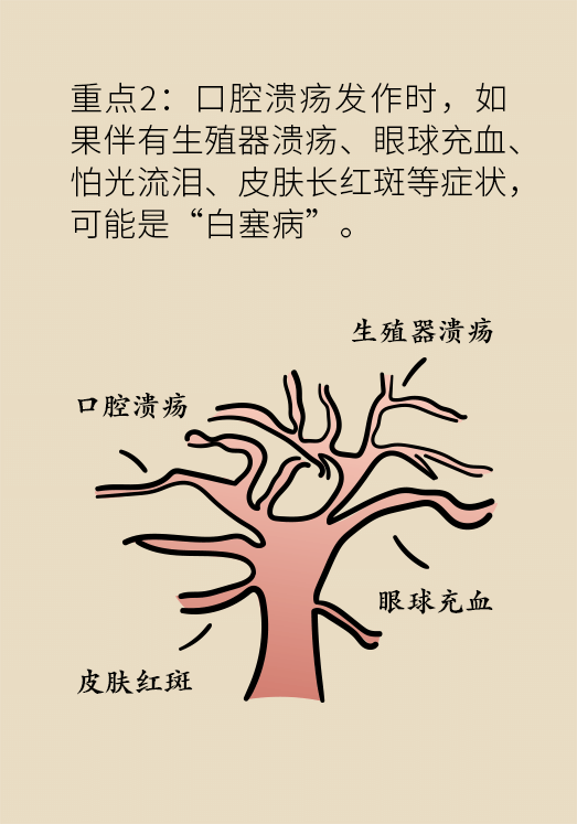 口腔潰瘍醫(yī)學(xué)知識科普動漫制作