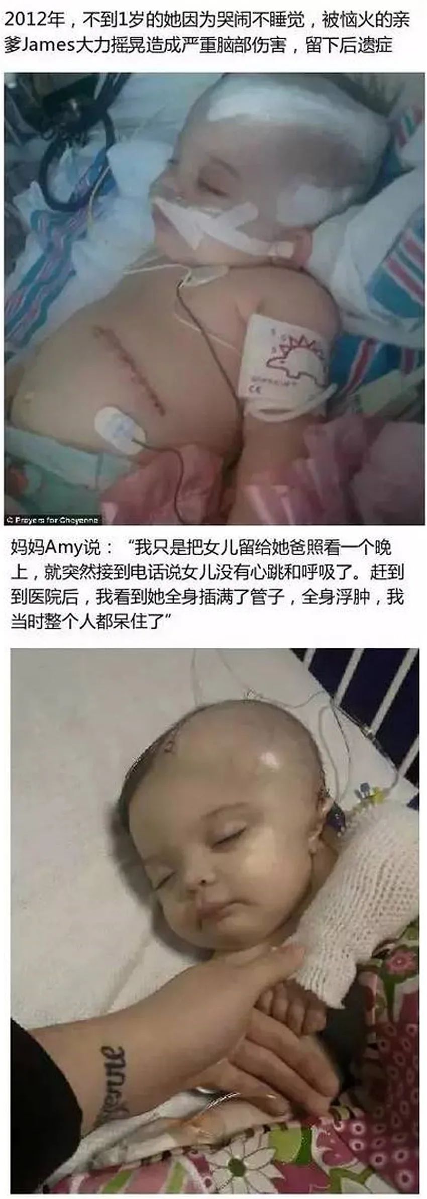 育兒醫(yī)學科普：大力搖晃會損傷寶寶的大腦致腦損傷