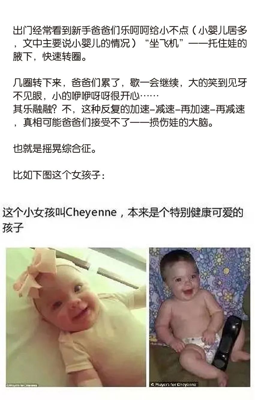 育兒醫(yī)學科普：大力搖晃會損傷寶寶的大腦致腦損傷