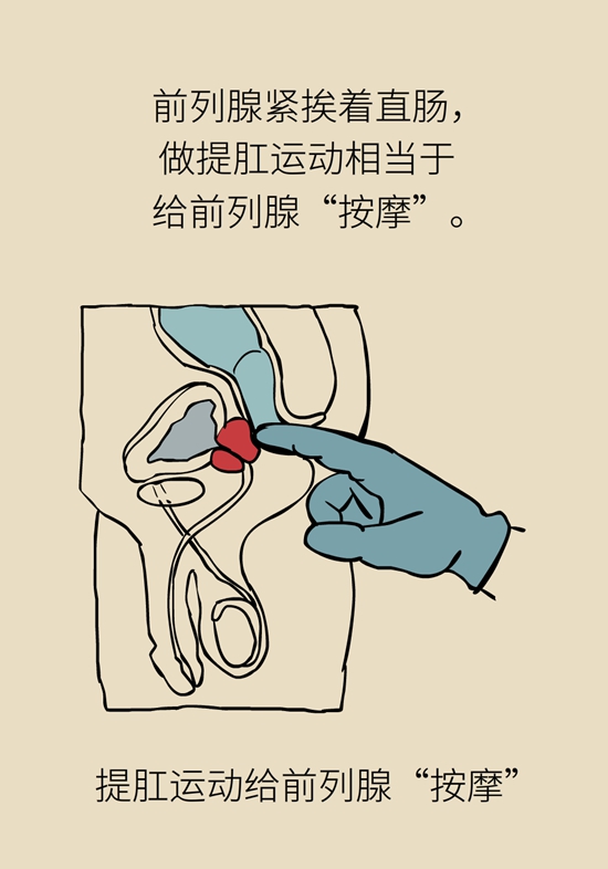 怎么做可以預(yù)防痔瘡呢？按摩前列腺、鍛煉盆底肌